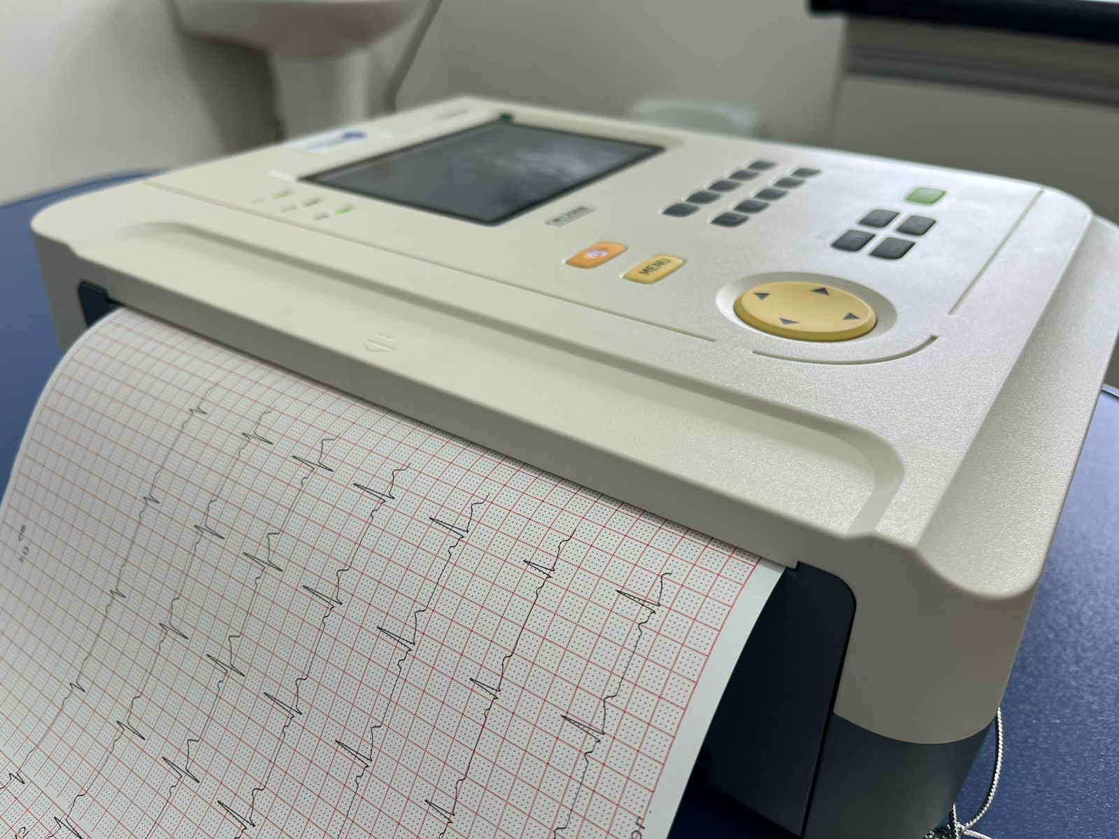 Município conquista dois ecocardiógrafos para ampliar atendimentos nas UBSs